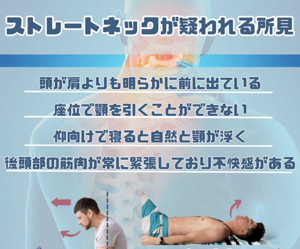 ストレートネックが疑われる所見