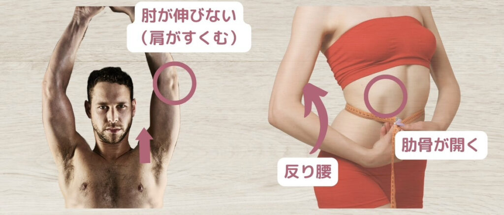 反り腰・肋骨の開きやバンザイで肘が曲がっている様子