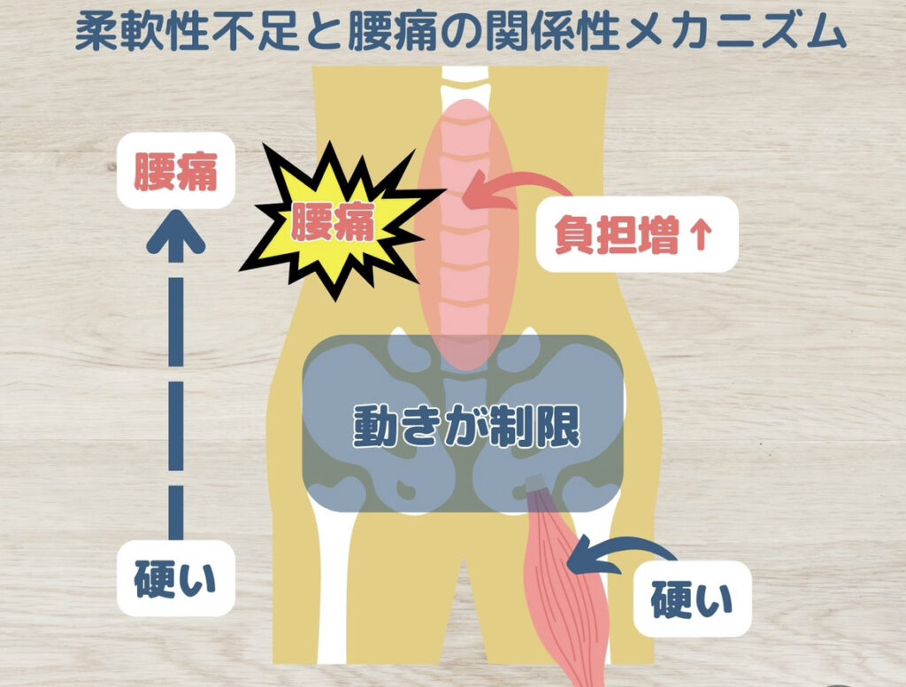 柔軟性不足のデメリット②腰痛のリスク上昇