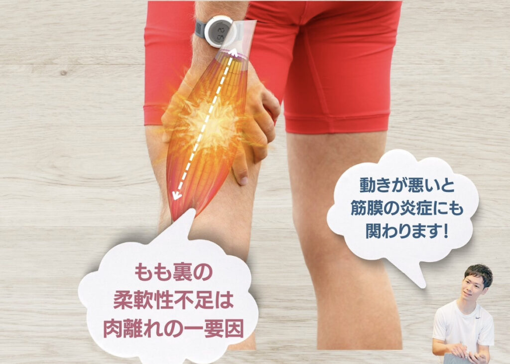 柔軟性不足のデメリット③肉離れ等のリスク上昇の危険性