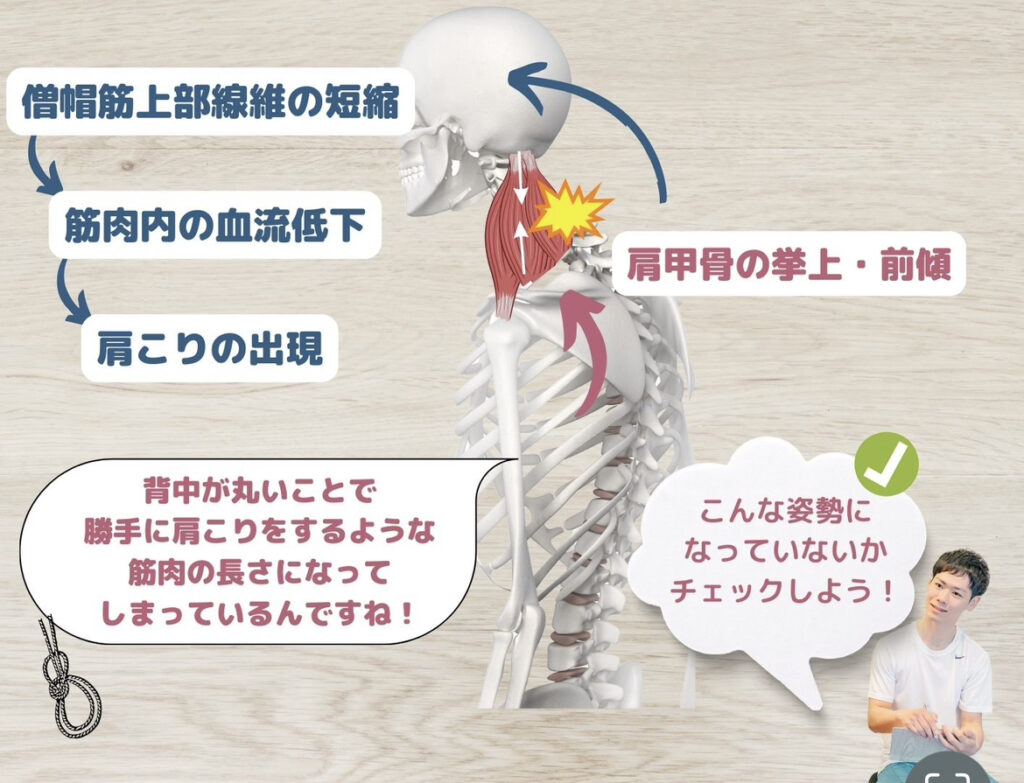 肩こりと背骨の関係性①猫背と肩こり