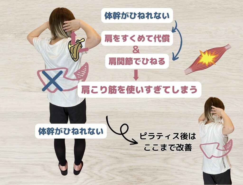 肩こりと背骨の関係性③背骨が捻れない事と肩こり