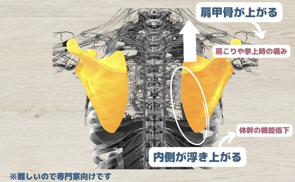 肩甲骨エラーの特徴