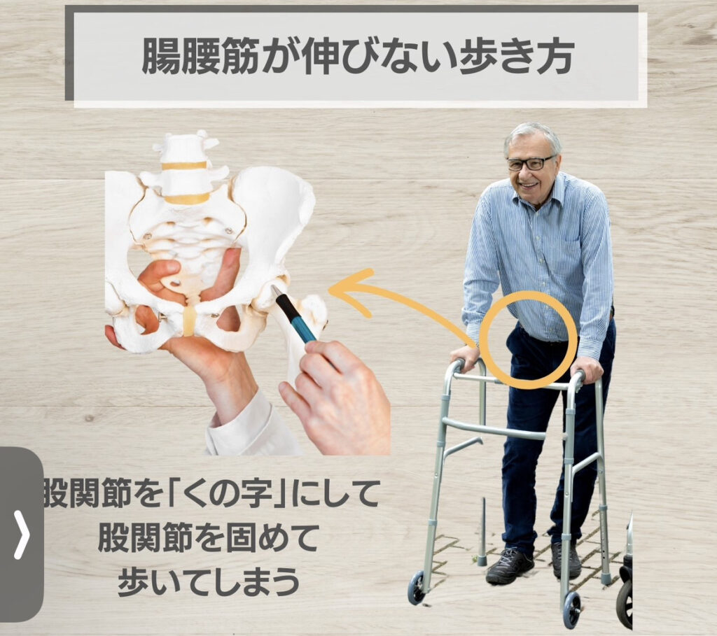 腸腰筋を使えない歩き方