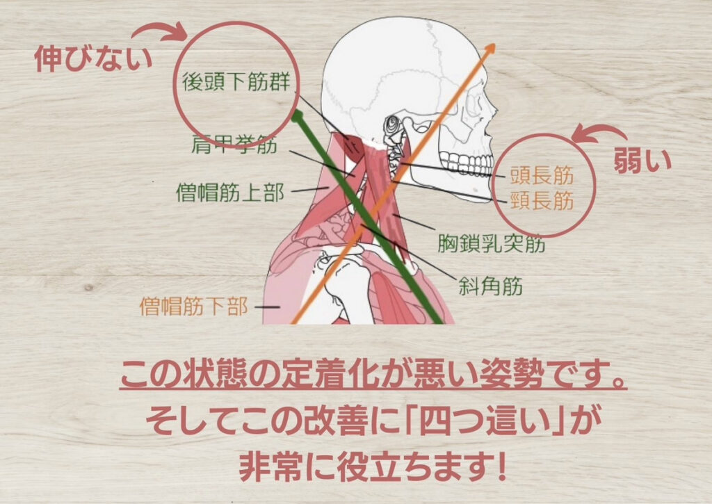 悪い姿勢の筋肉バランス