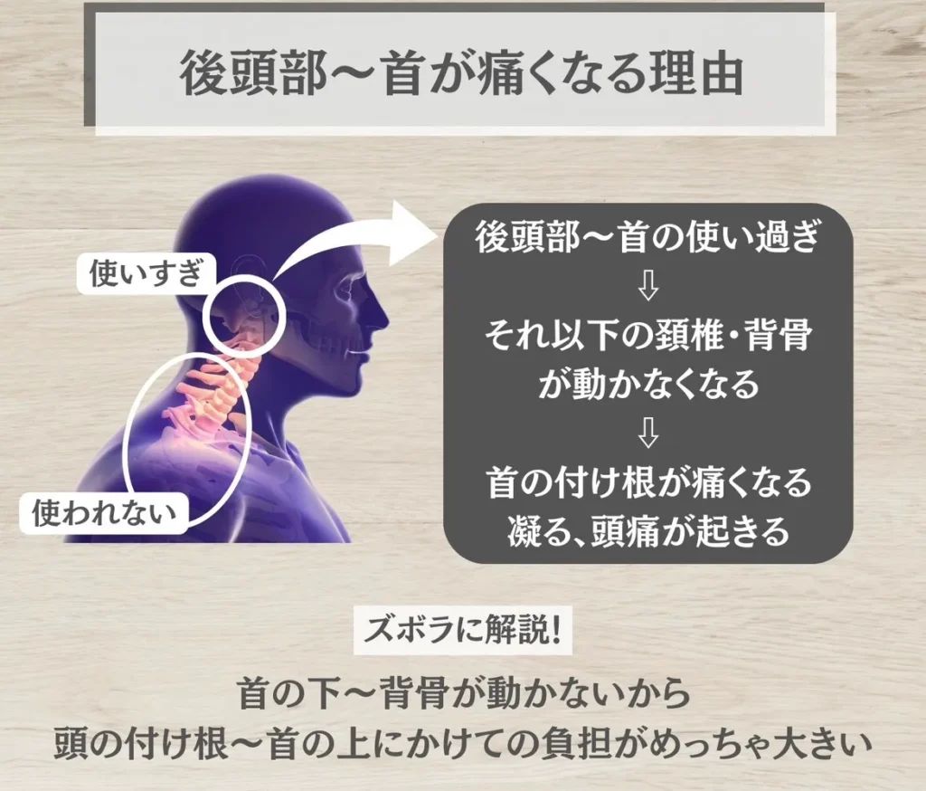 ストレートネックで後頭部や首が痛くなる理由