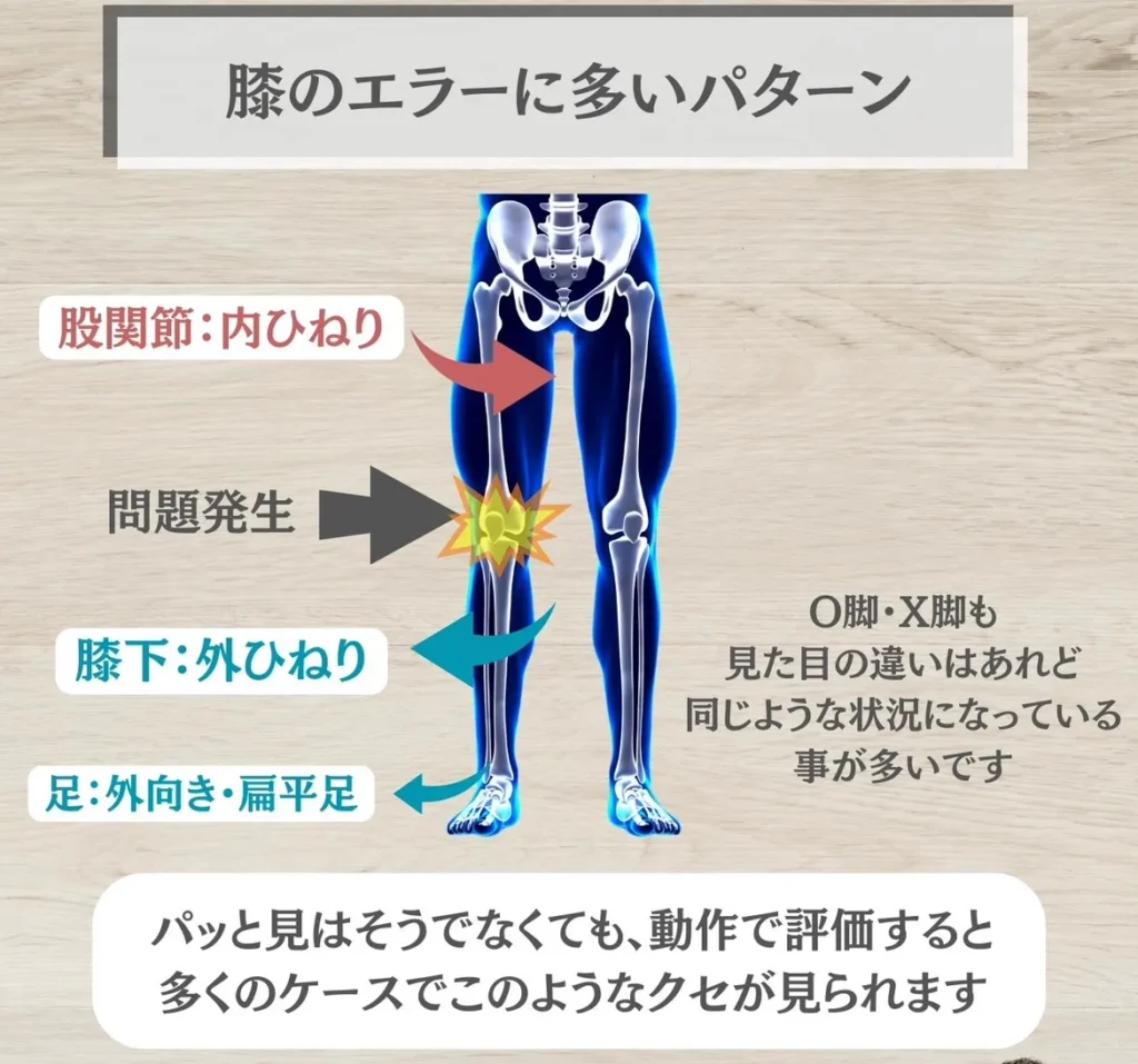 膝のエラーに多いパターン