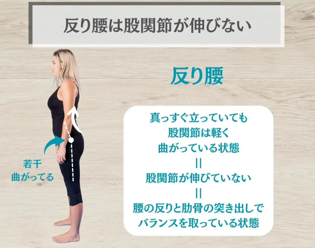 反り腰は股関節が伸びていない