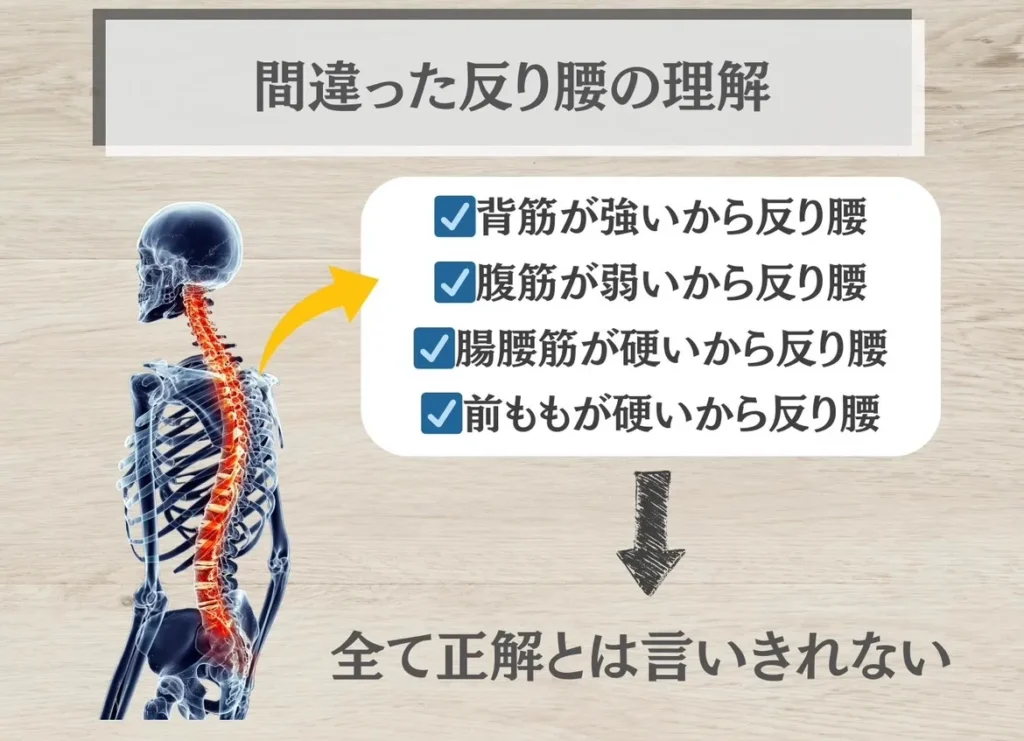 不完全な反り腰の理解として
