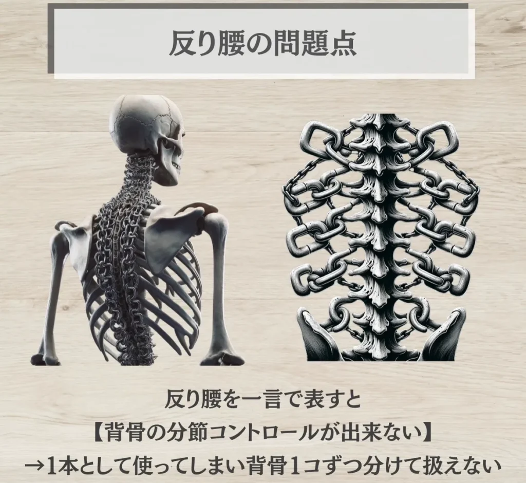 反り腰の問題点