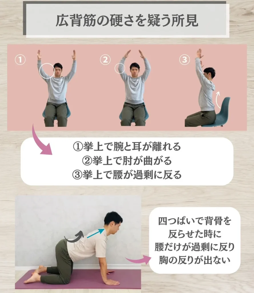 広背筋の硬さを疑う所見
