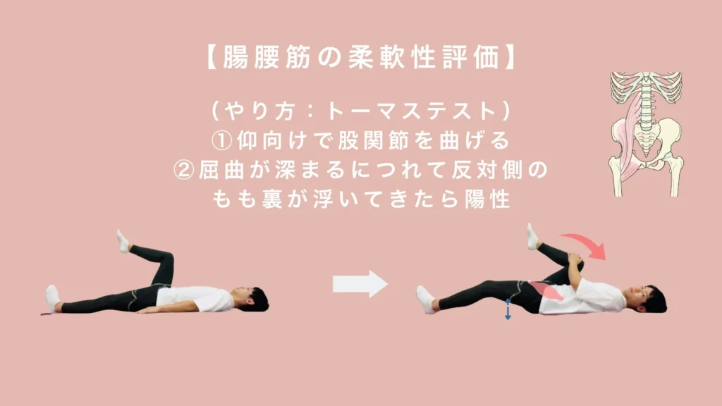 腸腰筋の柔軟性評価