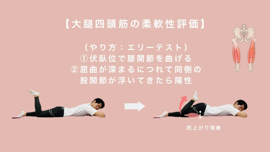 大腿四頭筋の硬さチェック