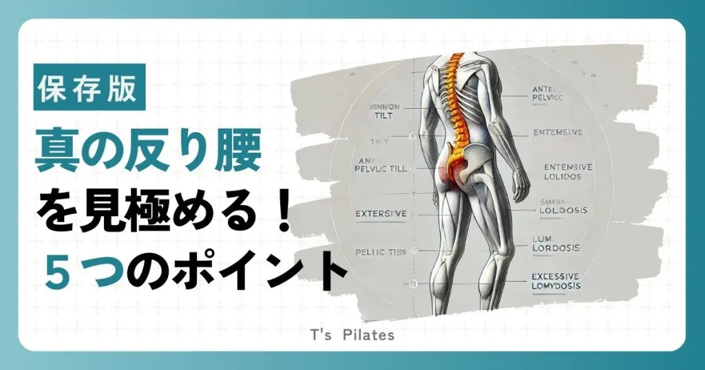 真の反り腰を見極める5つのチェック方法