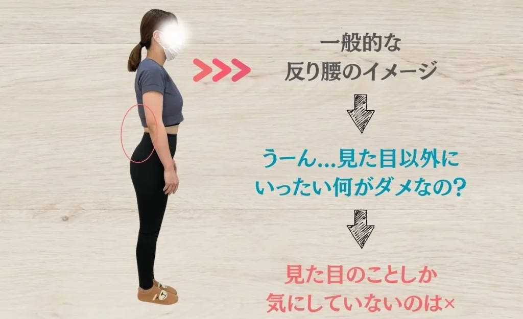 反り腰の一般的なイメージ