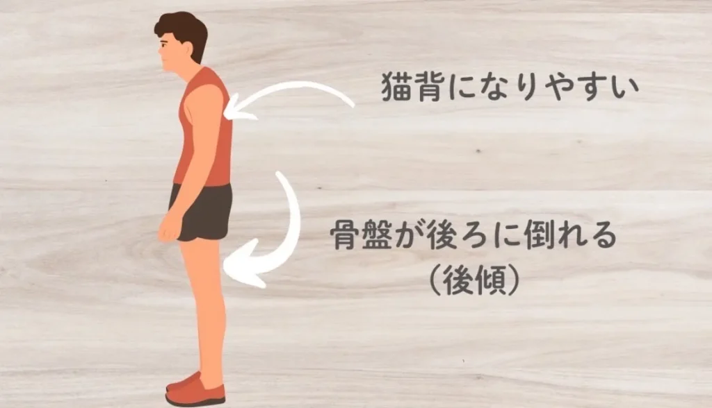 腸腰筋が弱いと猫背になりやすい 骨盤が後ろに倒れる