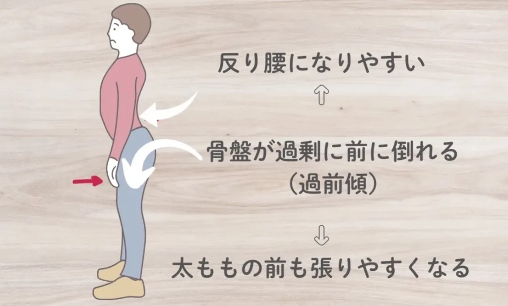 腸腰筋が硬いと反り腰になりやすい