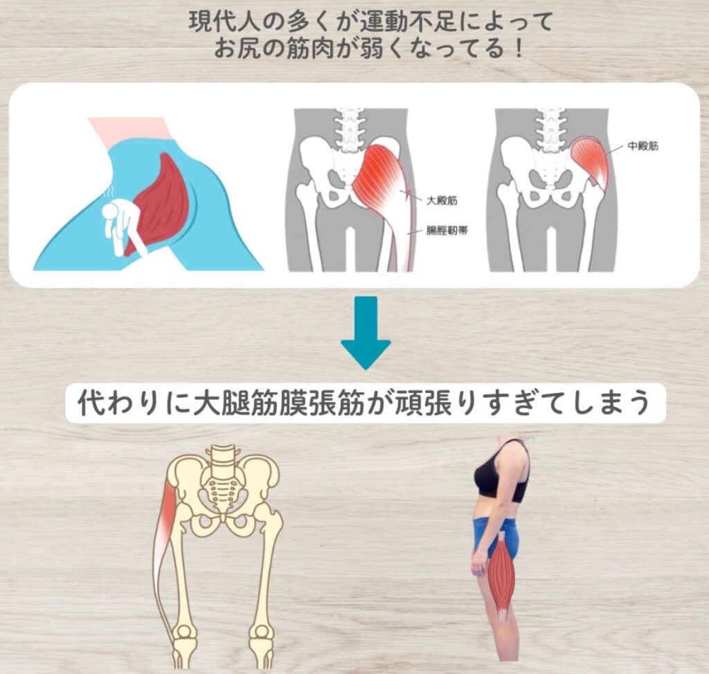 臀部筋力低下による大腿筋膜張筋の過緊張