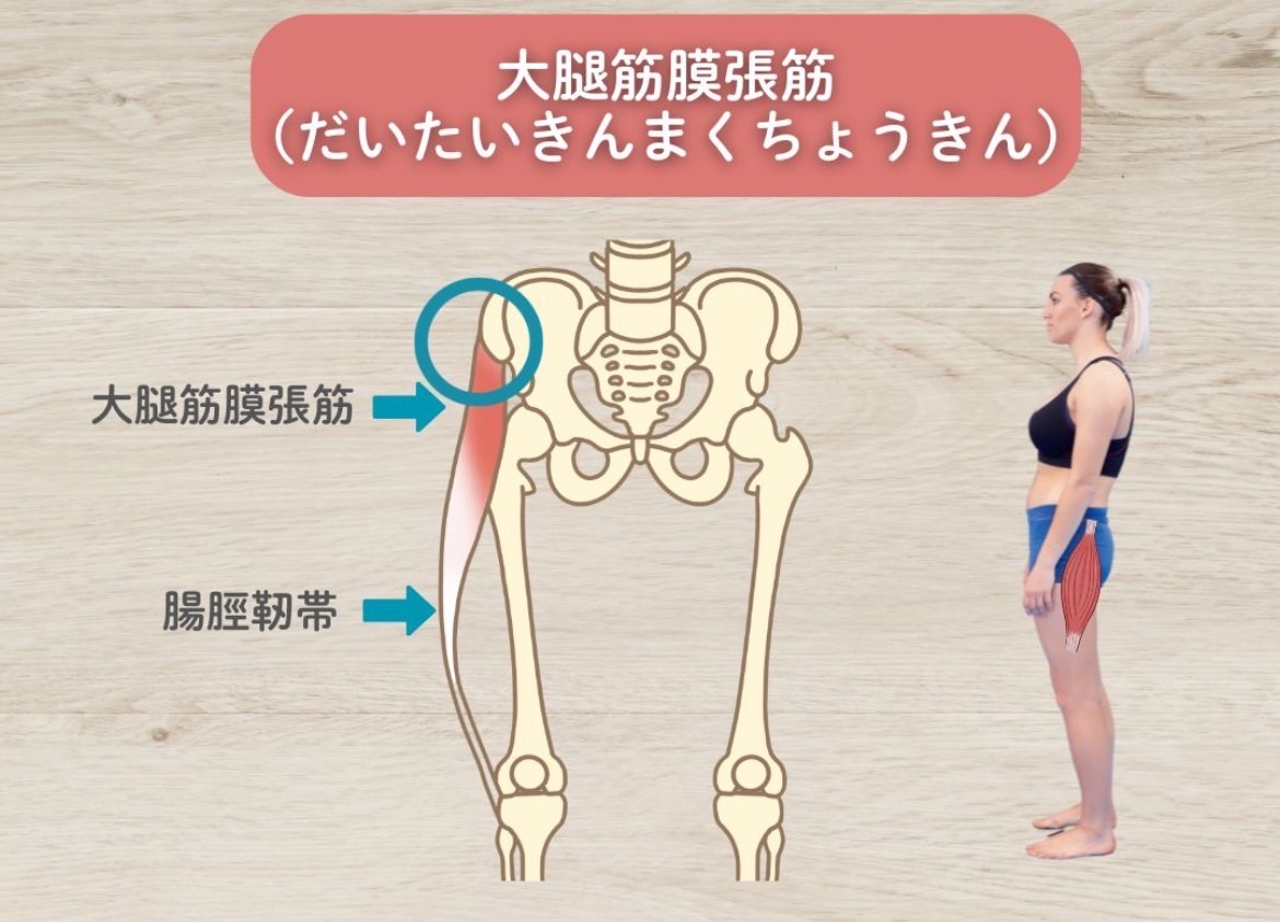 大腿筋膜張筋(TFL)