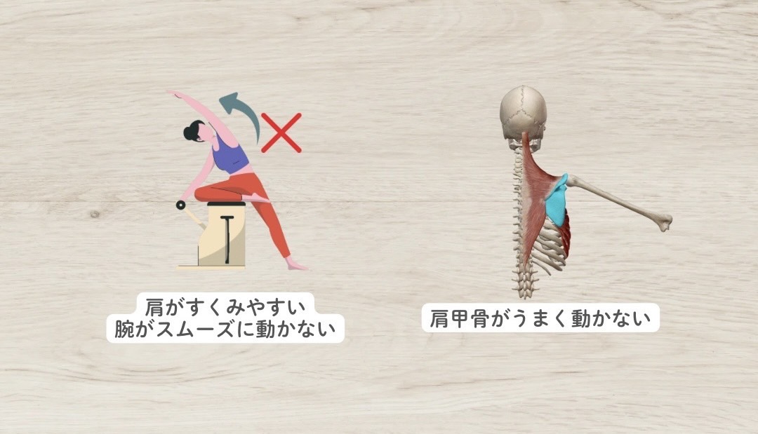 三角筋が緊張し過ぎているサイン