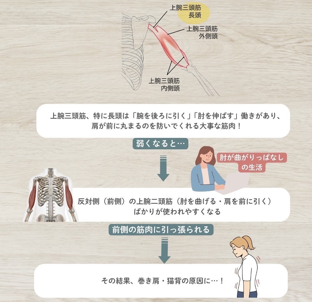 上腕三頭筋と姿勢の関係