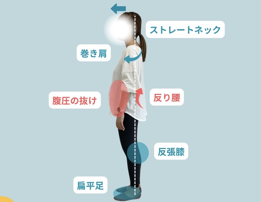 悪い姿勢の例
